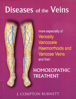 James Compton Burnett: Diseases of the Veins