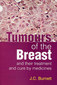 Tumours of the Breast / James Compton Burnett